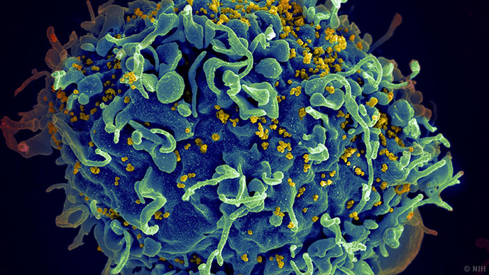 ea 201857151952628 - 美国约四成的HIV感染者不知自己被感染